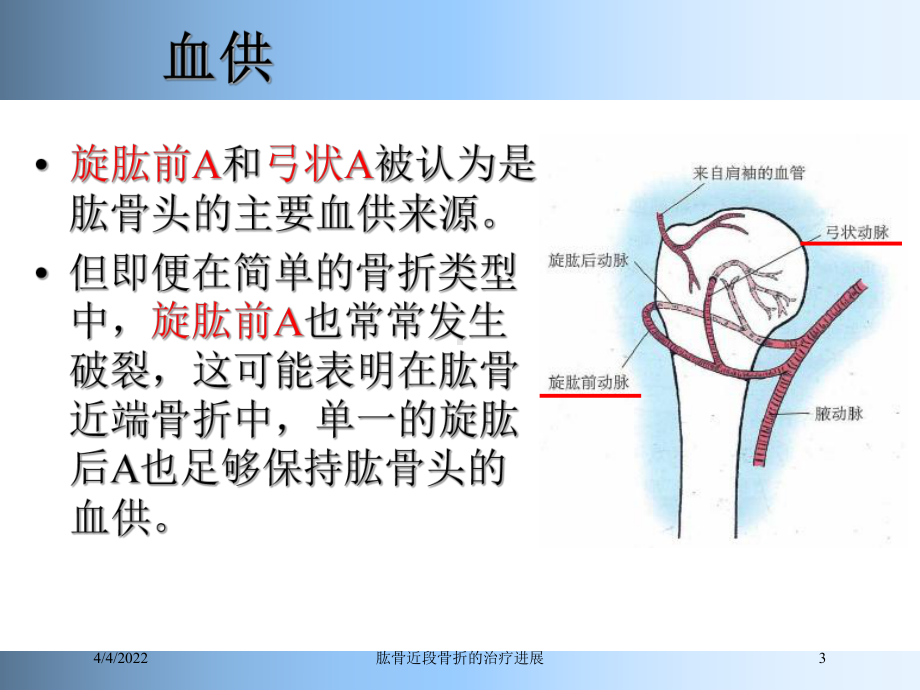 肱骨近段骨折的治疗进展培训课件.ppt_第3页