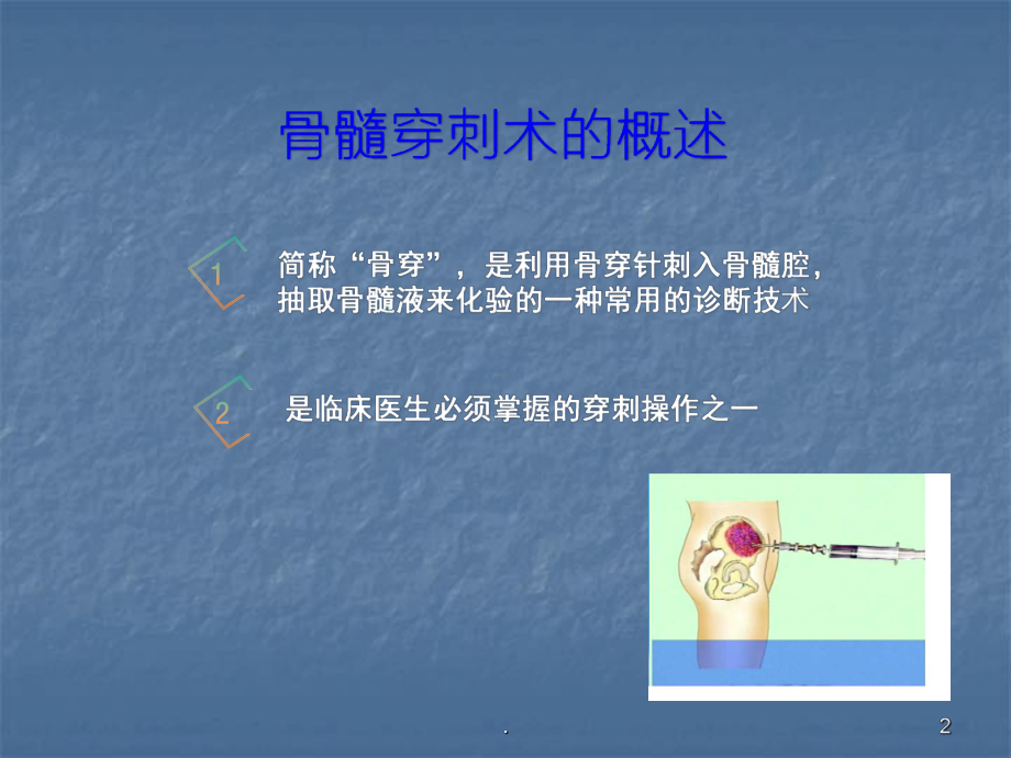 骨髓穿刺ppt演示课件.ppt_第2页