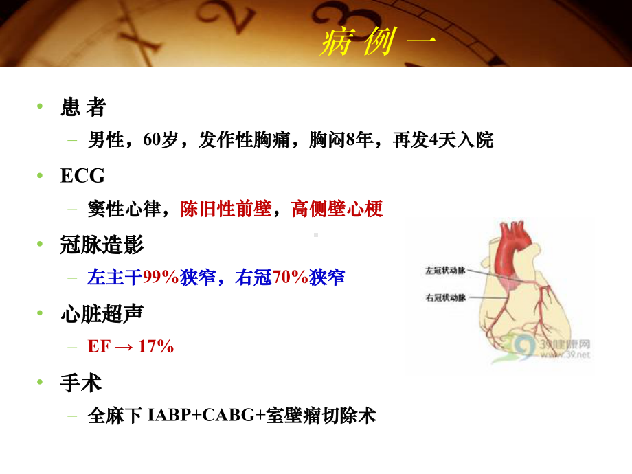 高龄髋部骨折患者手术麻醉PPT课件.ppt_第2页