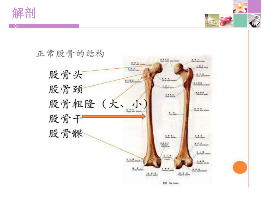 股骨干骨折护理PPT课件1.ppt_第3页