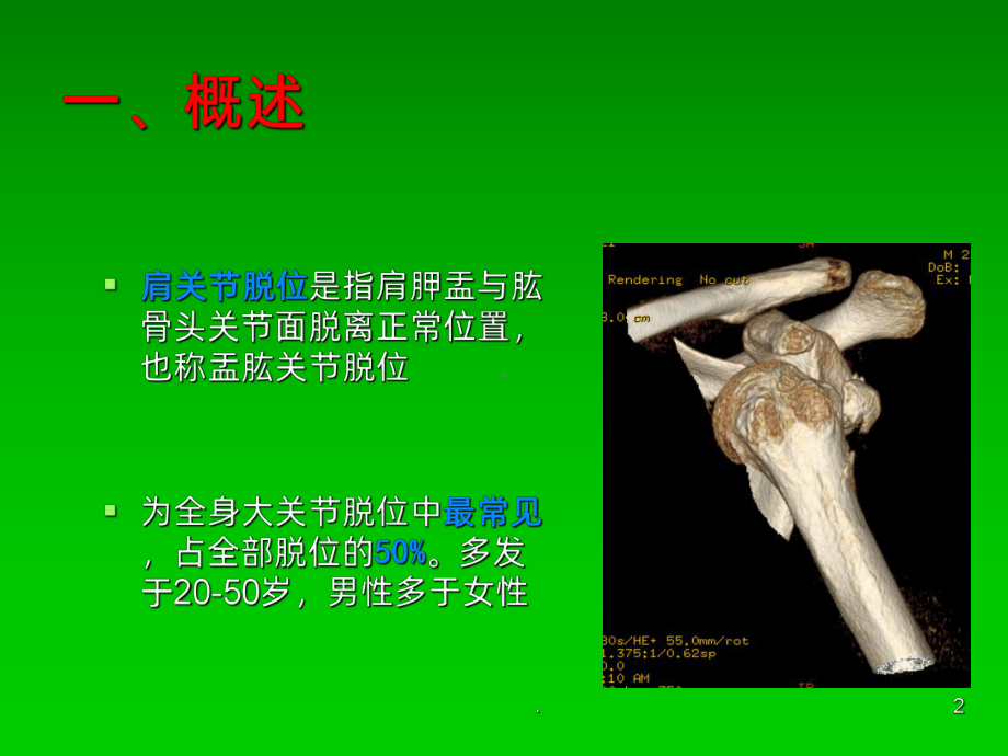 肩关节脱位(骨伤科)ppt课件.ppt_第2页