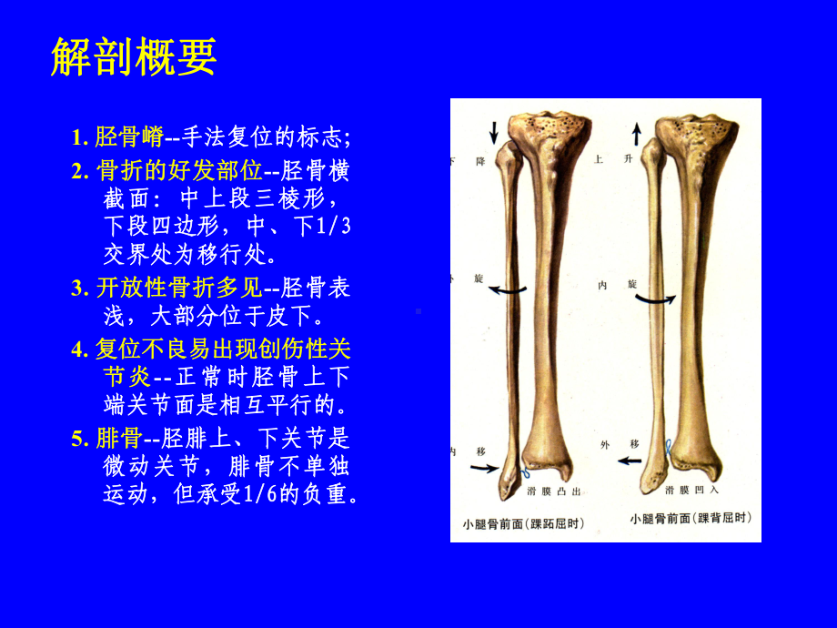 外科学多媒体课件 胫腓骨骨折.ppt_第2页