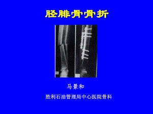 外科学多媒体课件 胫腓骨骨折.ppt