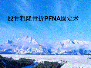 股骨粗隆骨折pfna固定术课件.ppt