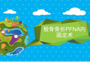 股骨骨折PFNA内固定术ppt课件.ppt