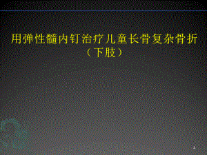 儿童长骨骨折弹性髓内钉PPT幻灯片课件.ppt