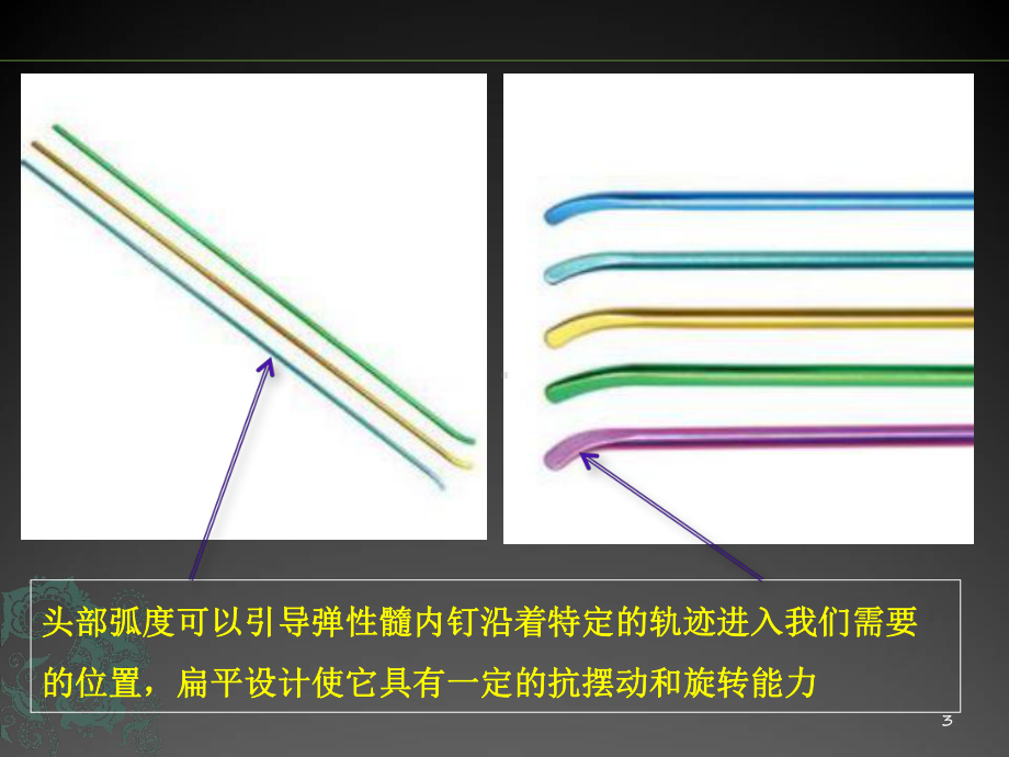 儿童长骨骨折弹性髓内钉PPT幻灯片课件.ppt_第3页