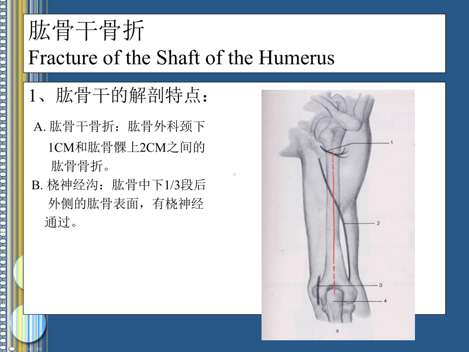 骨科创伤PPT课件1.ppt_第3页
