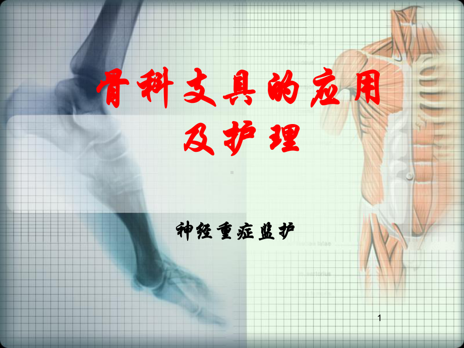 骨科支具的应用及护理PPT课件 (2).ppt_第1页