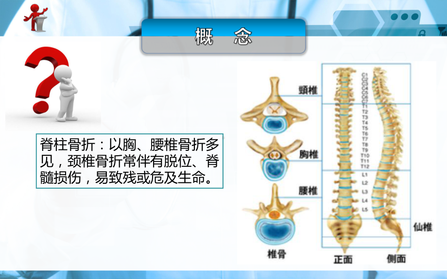 脊柱骨折及脊髓损伤病人的护理课件.ppt_第3页