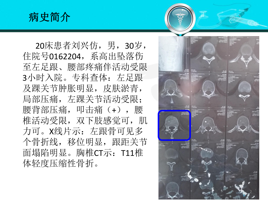 胸腰椎骨折PPT课件1.ppt_第2页