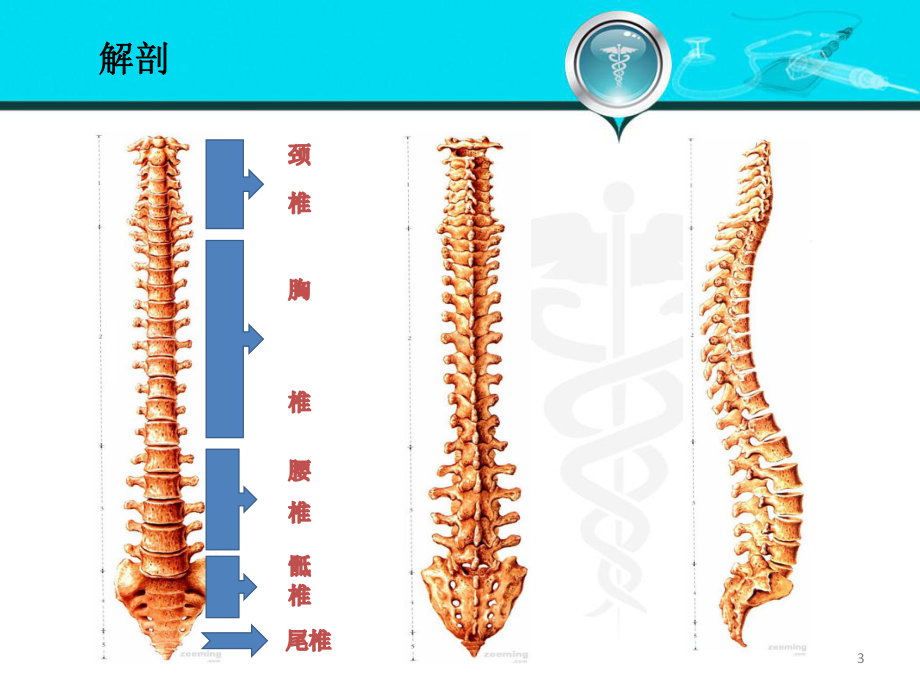 胸腰椎骨折PPT课件1.ppt_第3页