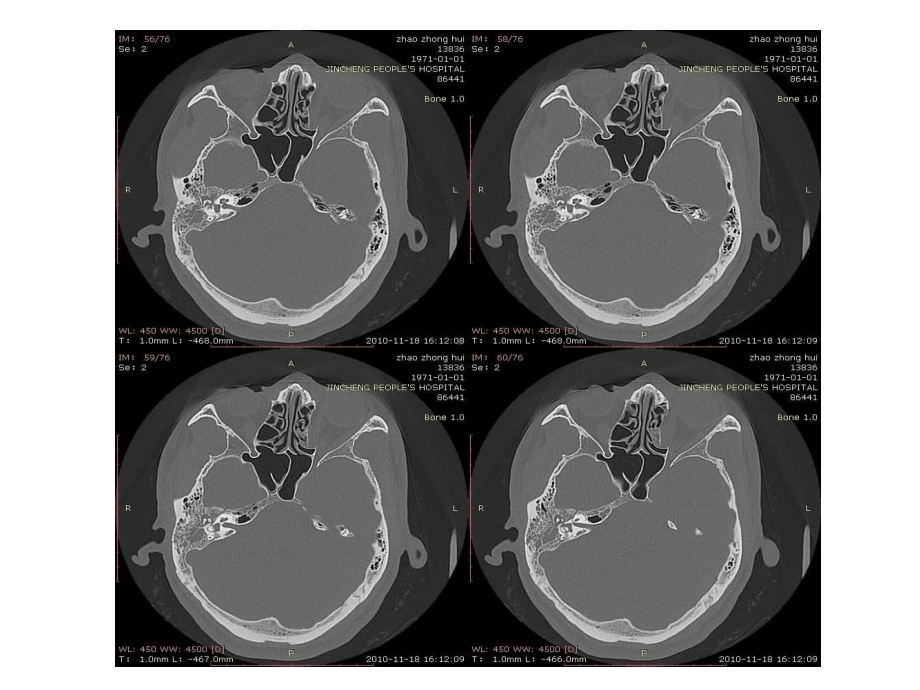 医学课件颅骨及眼眶骨性解剖.ppt_第3页