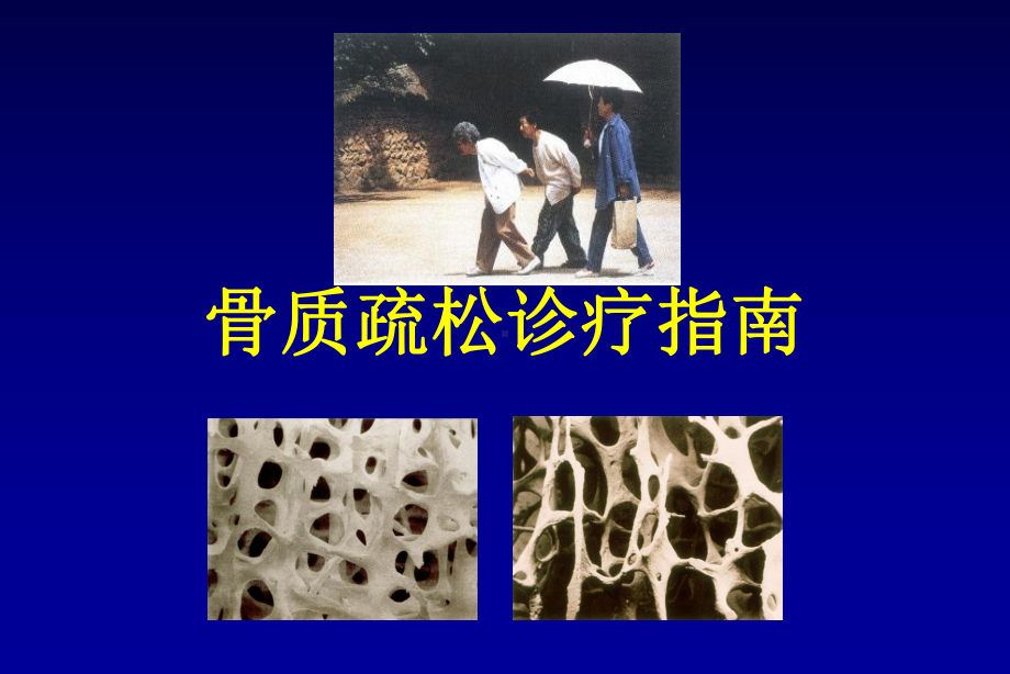 原发性骨质疏松症诊治指南课件.ppt_第1页