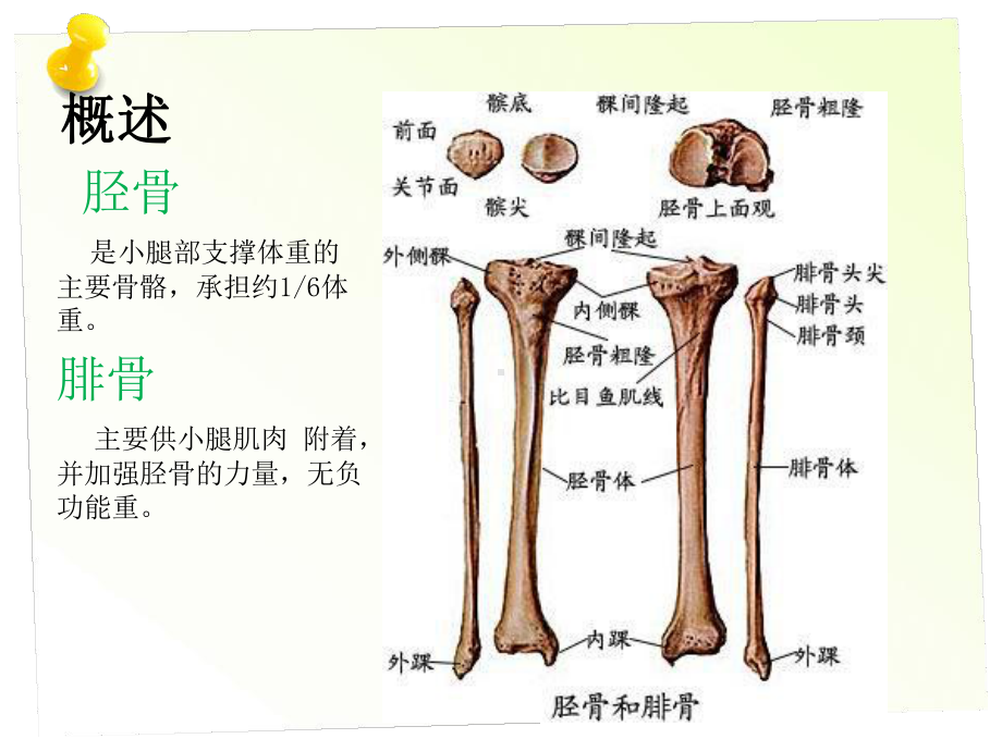 胫腓骨骨折的护理课件.pptx_第3页