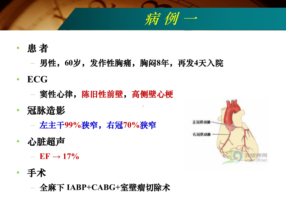 高龄髋部骨折患者手术麻醉1课件.ppt_第2页