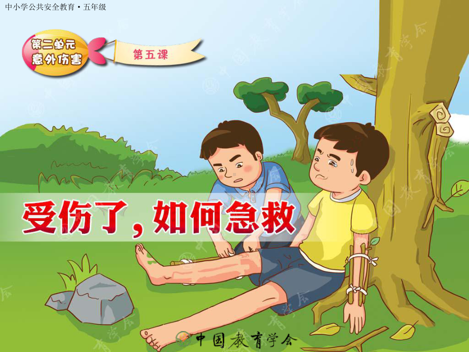 骨折时如何急救-安全教育平台课件.ppt_第1页