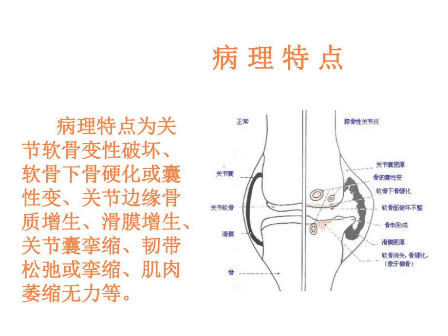 骨性关节炎的康复PPT课件.ppt_第3页