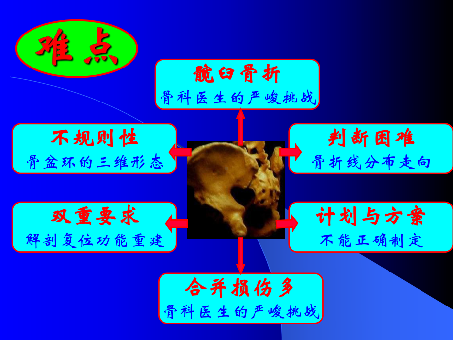 髋臼骨折的诊治难点及手术策略分析课件.ppt_第2页