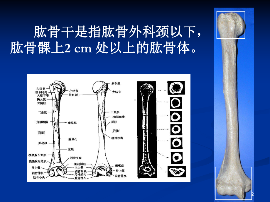 肱骨干骨折PPT课件2.ppt_第2页