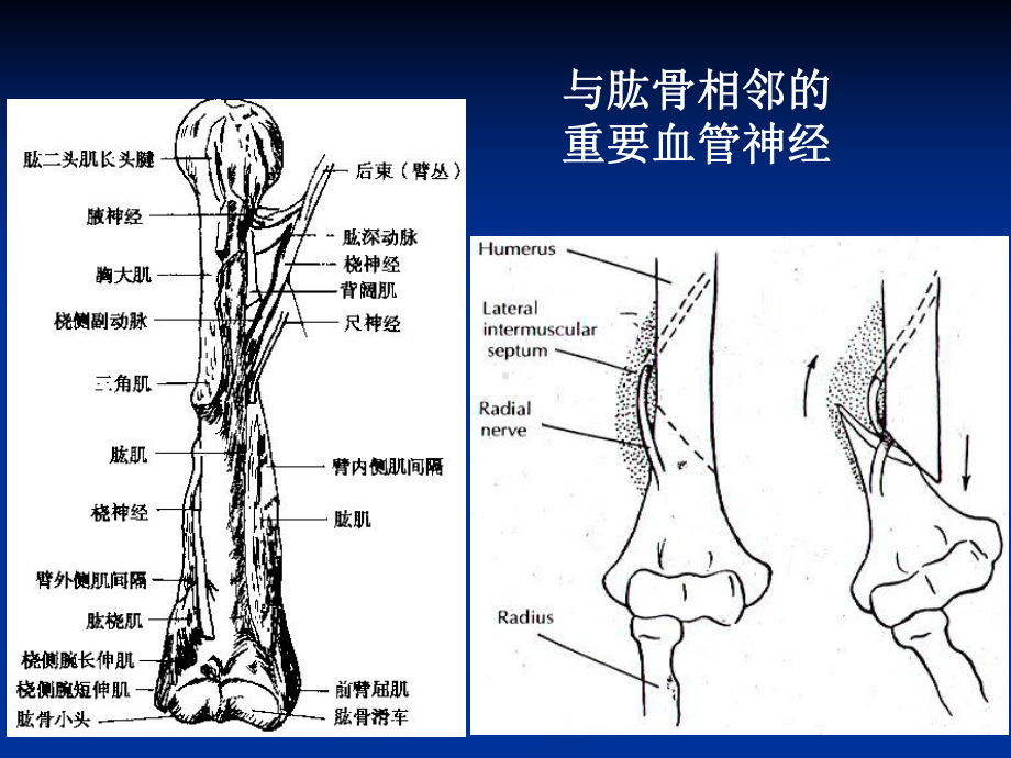 肱骨干骨折PPT课件2.ppt_第3页