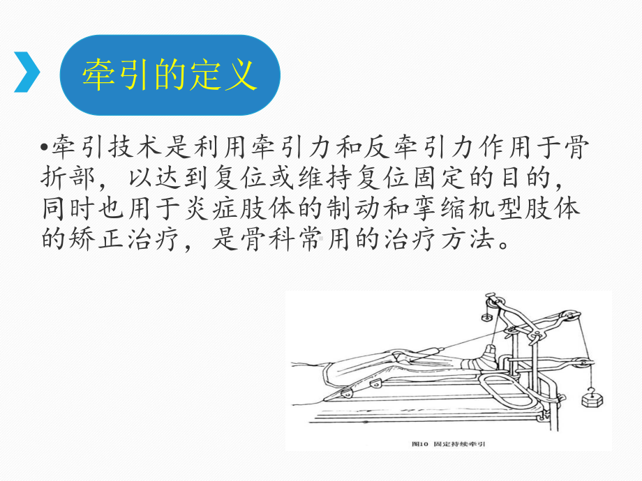 骨科牵引技术及护理PPT课件.ppt_第3页