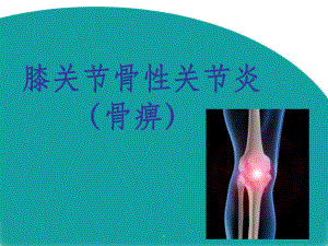 膝关节骨性关节炎完整版本课件.ppt