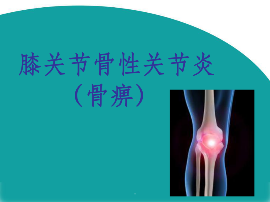 膝关节骨性关节炎完整版本课件.ppt_第1页