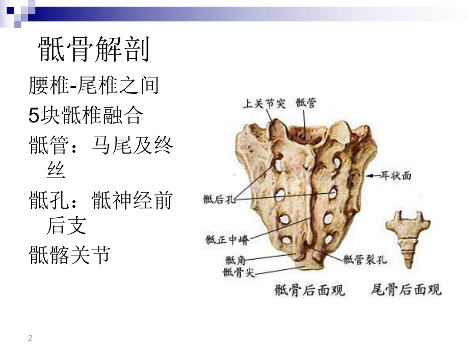 骶骨肿瘤课件.ppt_第2页