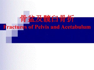 骨盆及髋臼骨折ppt课件.ppt