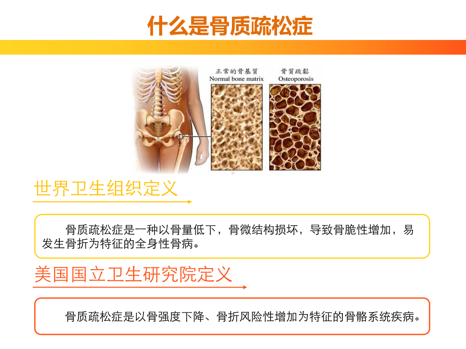 骨质疏松健康讲座精品PPT课件.pptx_第3页