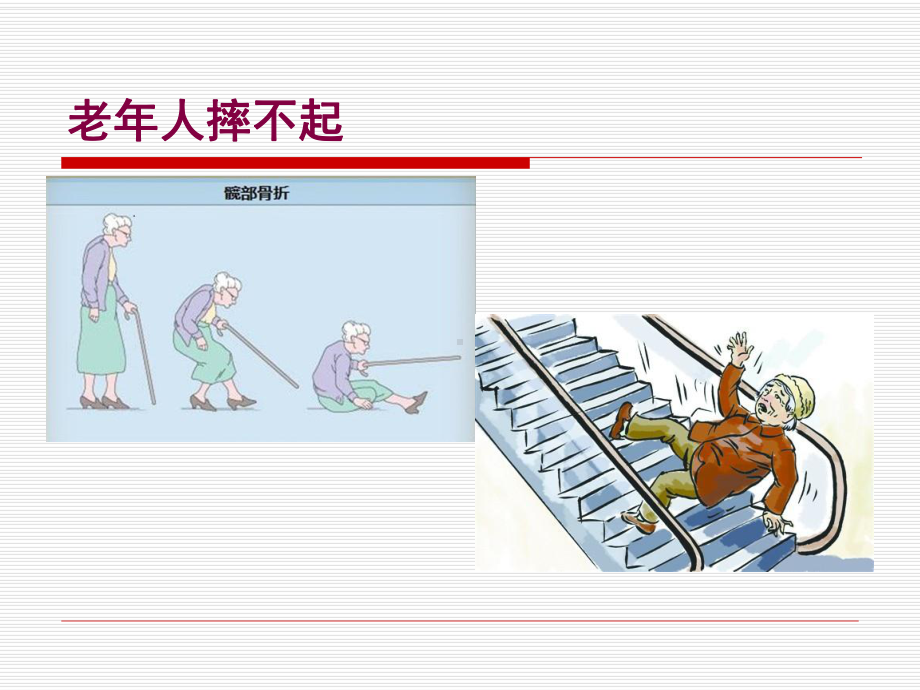 老年髋部骨折1课件.ppt_第2页