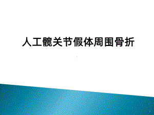 人工髋关节假体周围骨折课件.ppt