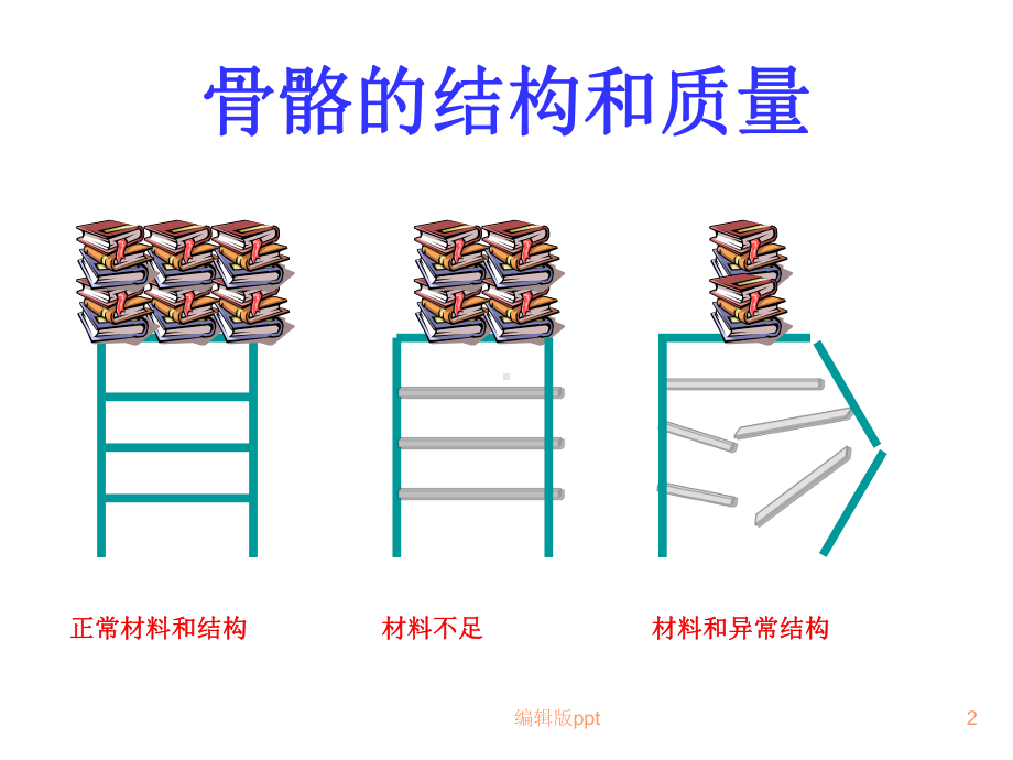 风湿病和骨质疏松症医学PPT课件.ppt_第2页