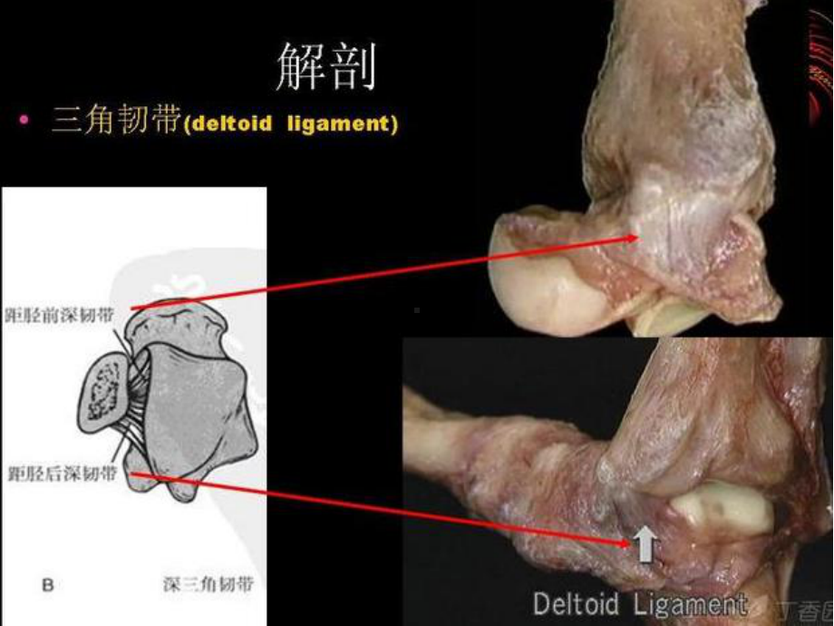 踝关节骨折Lauge-hansen分型的理解与评课件.ppt_第3页