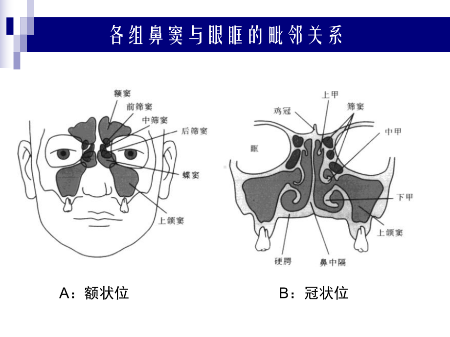 鼻、鼻窦和头颈部肿瘤的麻醉处理课件.ppt_第3页