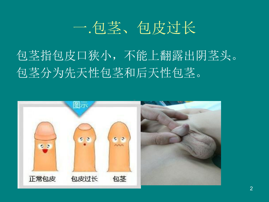 小儿泌尿系统疾病ppt课件.pptx_第2页