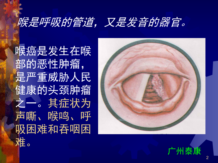 喉癌治疗的新进展课件.ppt_第2页