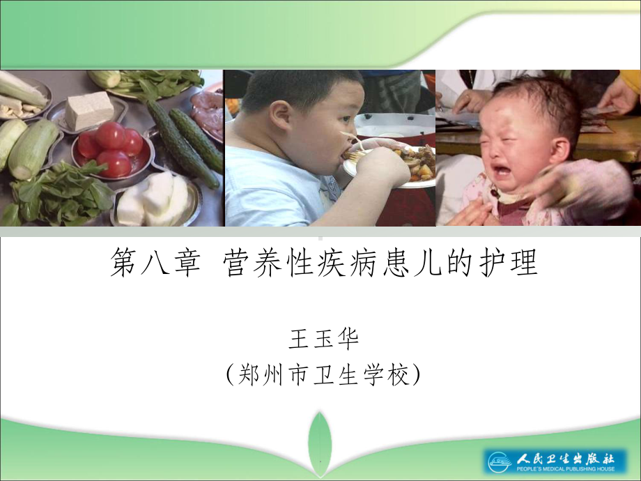 第八章营养性疾病患儿的护理课件.ppt_第2页