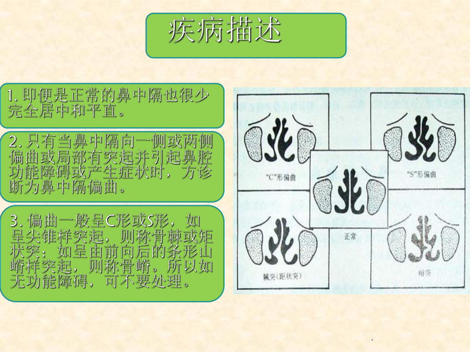 鼻中隔偏曲护理教学课件.ppt_第3页