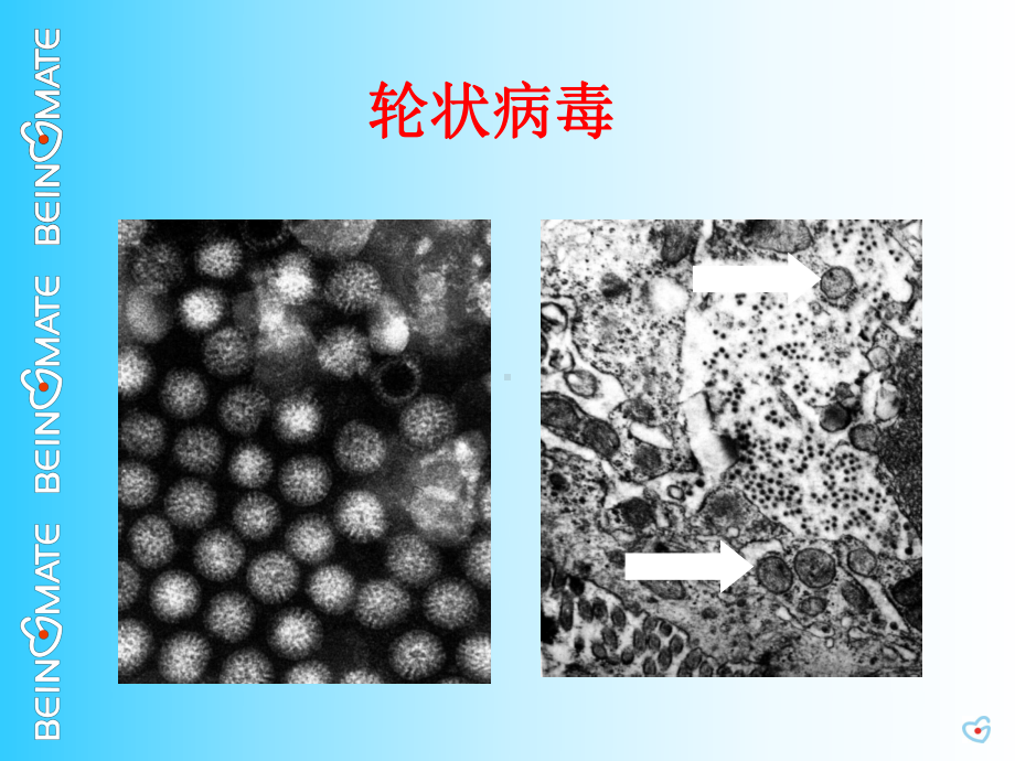 婴幼儿秋季常见病护理课件.ppt_第3页