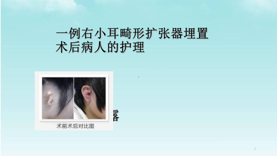 小耳畸形的护理查房和健康教育ppt课件.ppt_第1页