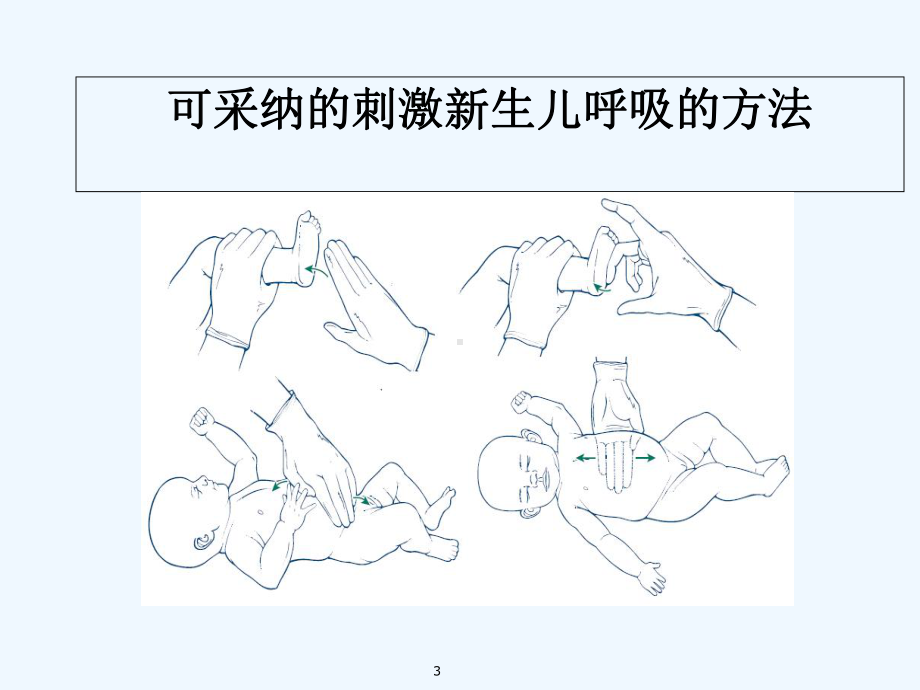 小儿心肺复苏-PPT课件.ppt_第3页