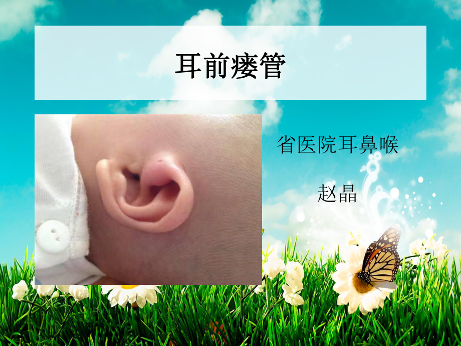 耳前瘘管ppt课件.ppt_第1页