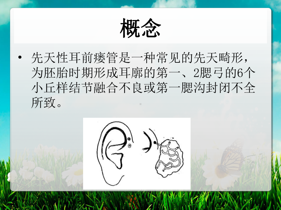 耳前瘘管ppt课件.ppt_第2页