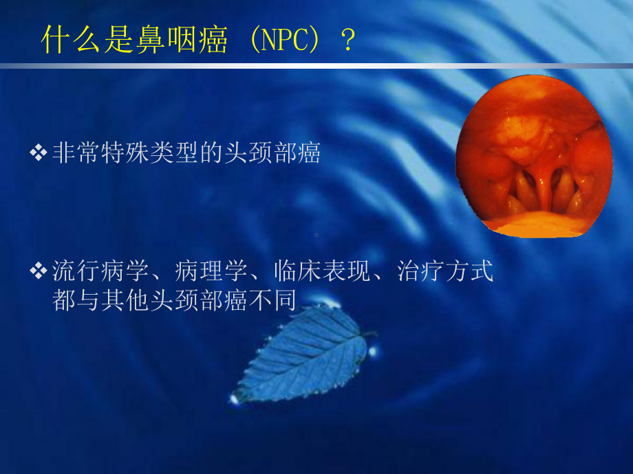 鼻咽癌的诊断与鉴别诊断1课件.ppt_第2页