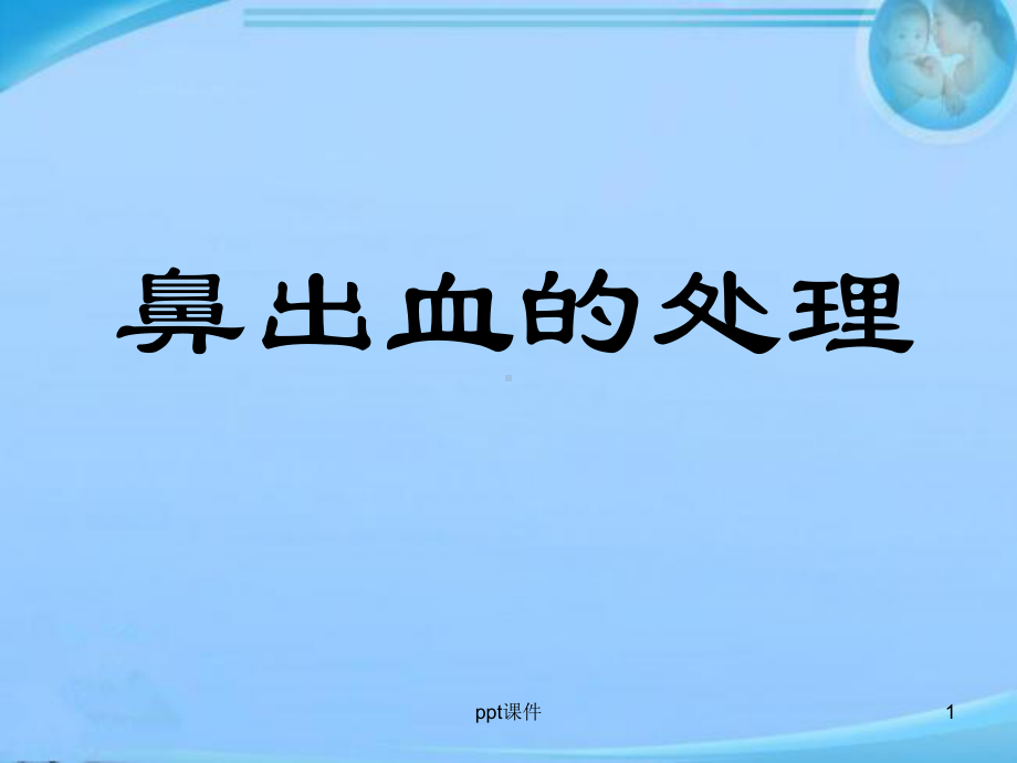 鼻出血处理-ppt课件.ppt_第1页