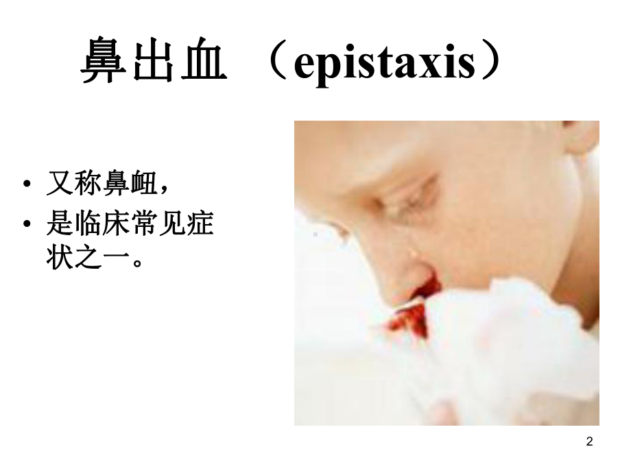 鼻出血病人的护理PPT课件.ppt_第2页