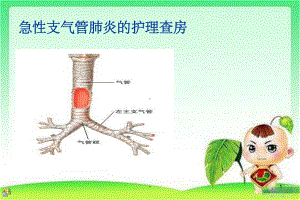 小儿急性支气管炎的护理查房-ppt课件.ppt