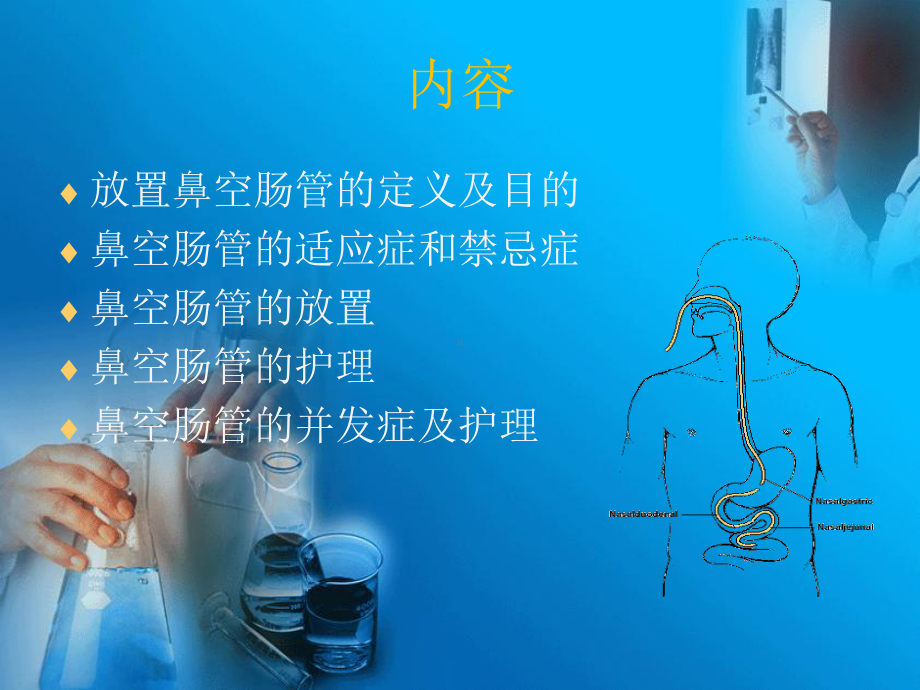 鼻肠管护理课件.ppt_第2页